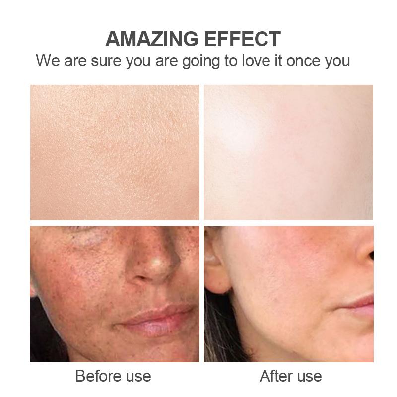 Natural Kojic Face Cleanser